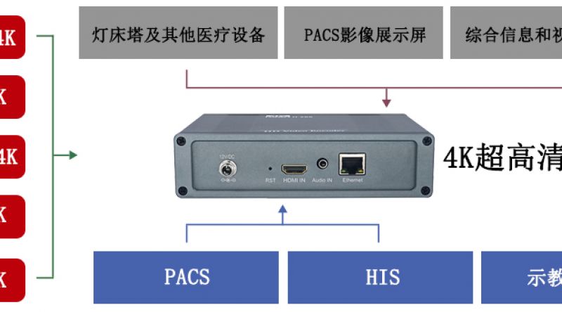 医院如何实现4K高清数字一体化手术室